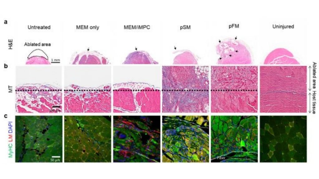 Bioengineered hybrid muscle fiber for regenerative medicine - Vigor Column