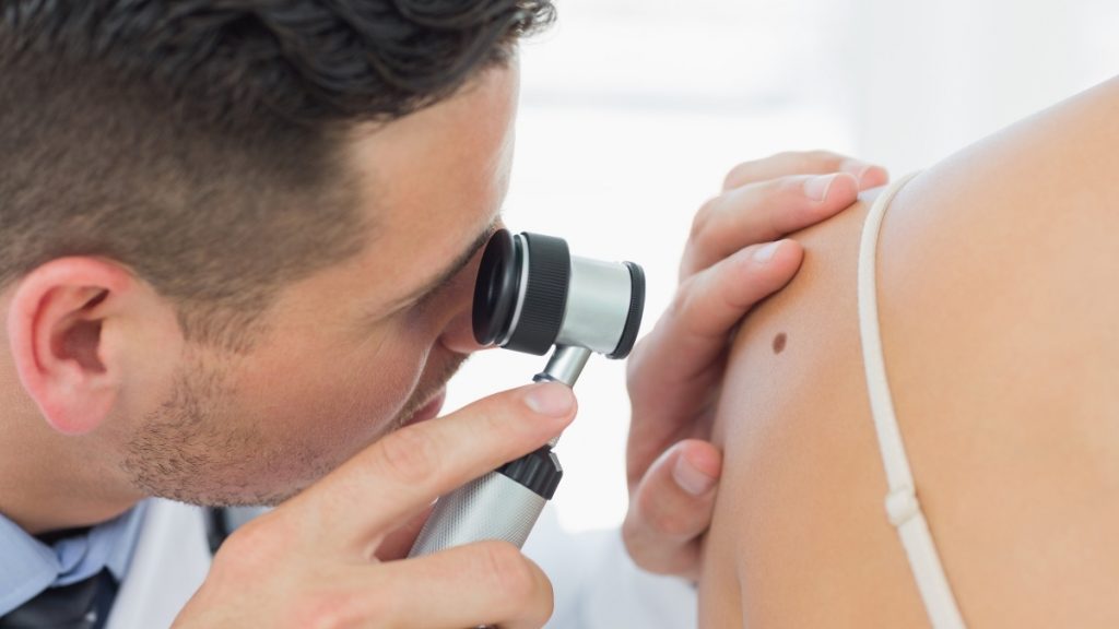 Scientists discover a prototype test to help in fighting melanoma - Vigor Column