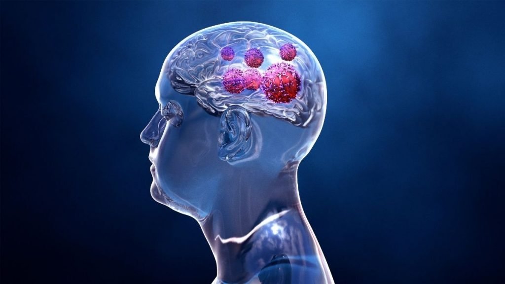 New Potential Approach Against Fatal Childhood Brain Cancer